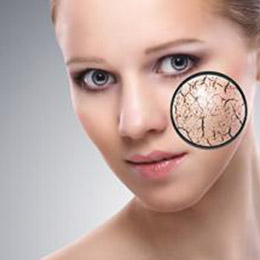 Dry Skin
